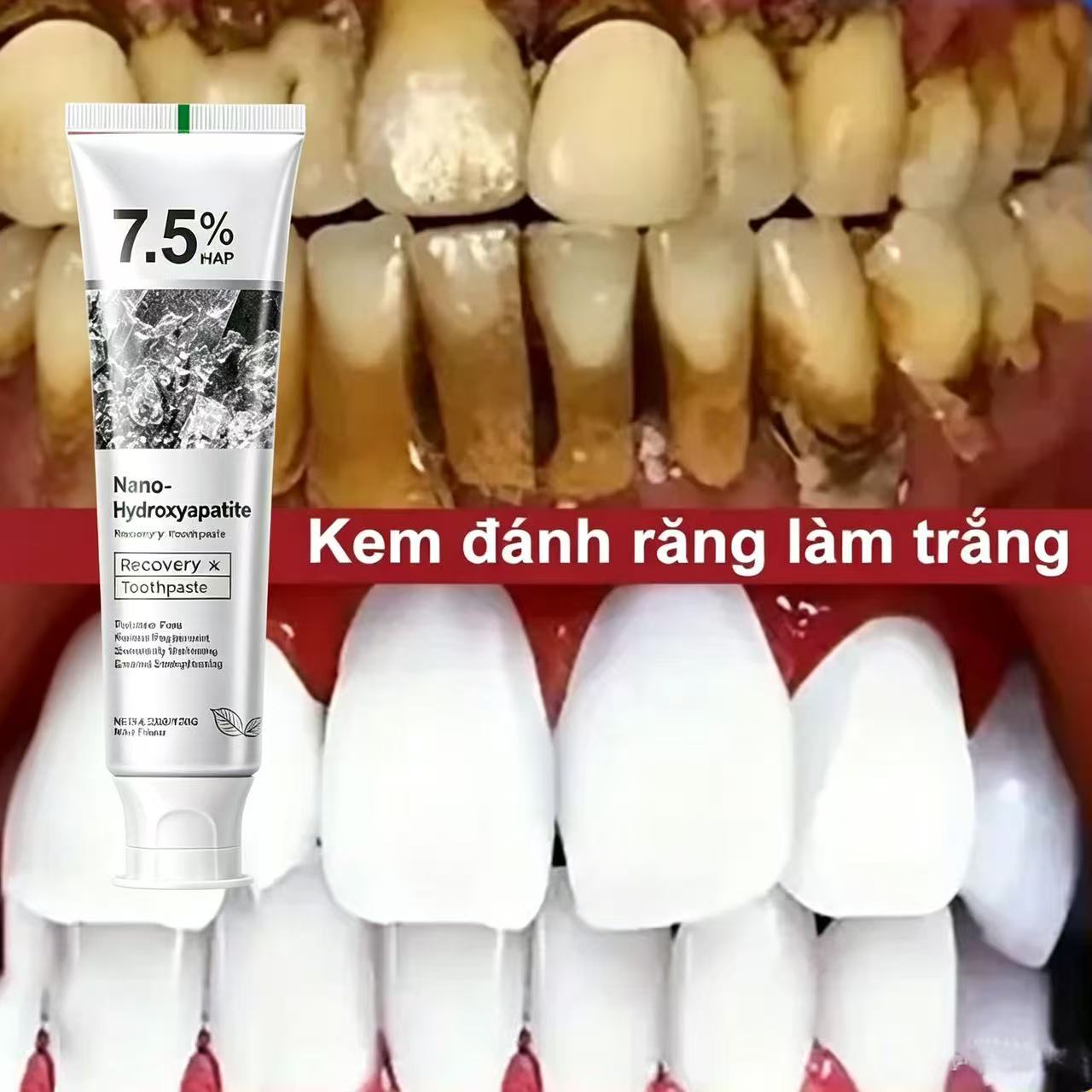 Teeth Whitening Treatment - 7,5% Hydroxyapatiet Probiotische Whitening Tandpasta Emaille