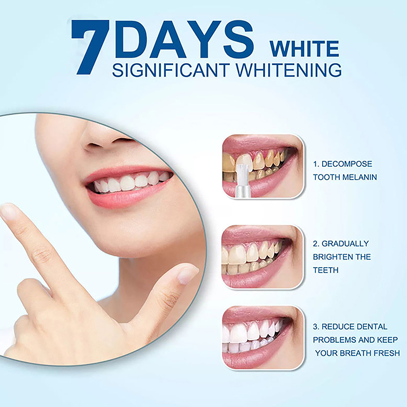 Tandenbleekpen Professionele T - Whitening Pen Bleach recensie en prijs