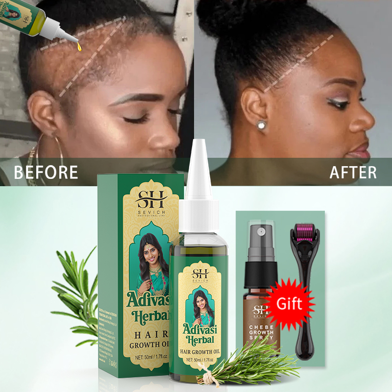 Ayurvedische haargroeiolie Ind - Coconut Oil Pull recensie en prijs