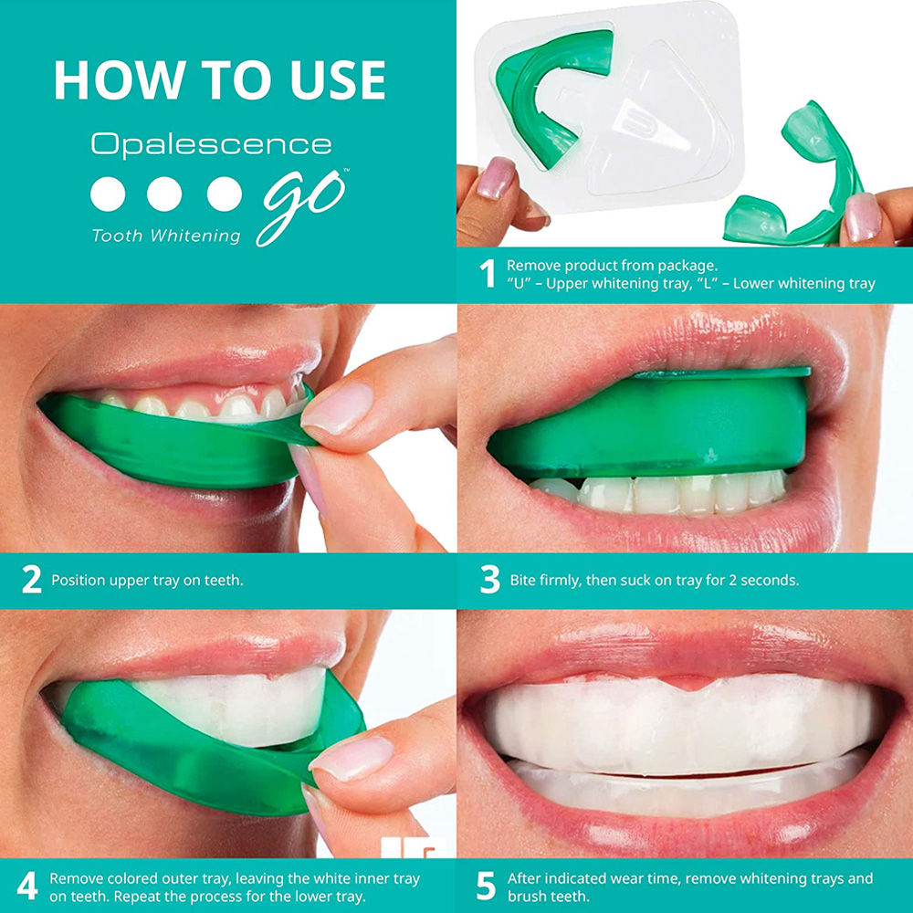 Waterstofperoxide Voor Tanden  - Teeth Whitening In Office recensie en prijs