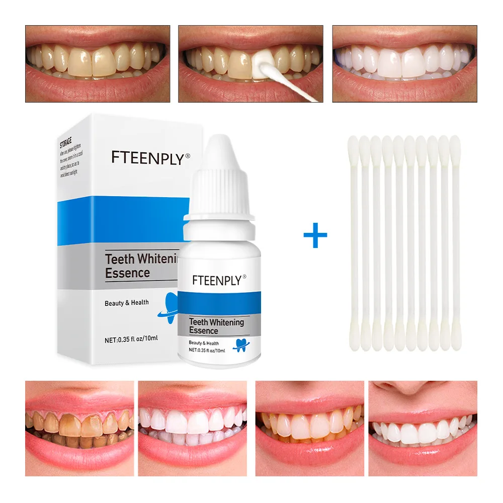 Fteenply Tanden Whitening Esse - Teeth Whitening Treatment recensie en prijs