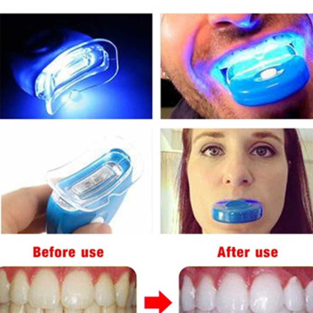 Nieuwe Blauwe Led Tanden Bleke - Teeth Whitening Laser recensie en prijs