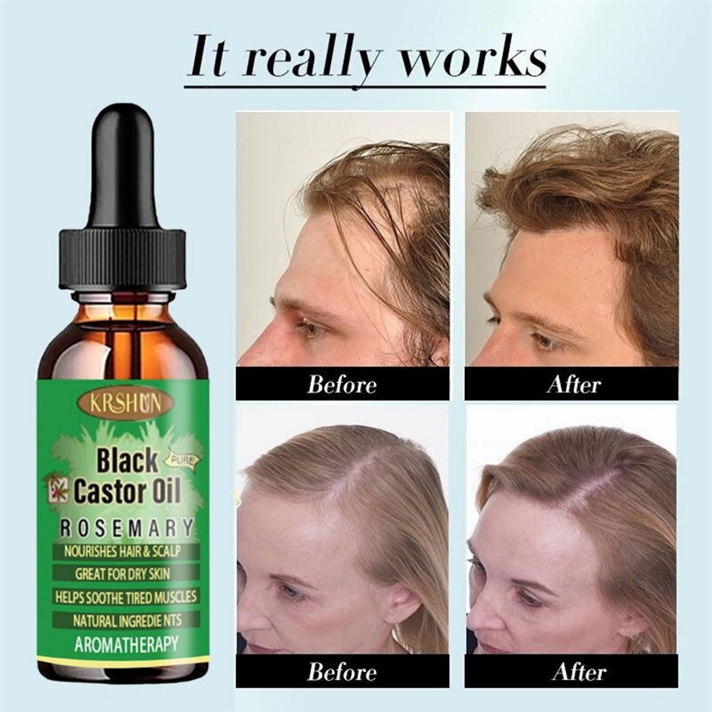 Zwarte ricinusolie voedt haarg - Coconut Oil Pull recensie en prijs