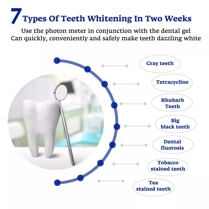 Tanden Whitening Accelerator S - Teeth Whitening Laser recensie en prijs