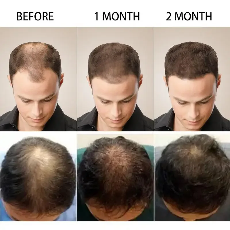 Haargroei Gember Snelgroeiend  - Coconut Oil Pull recensie en prijs